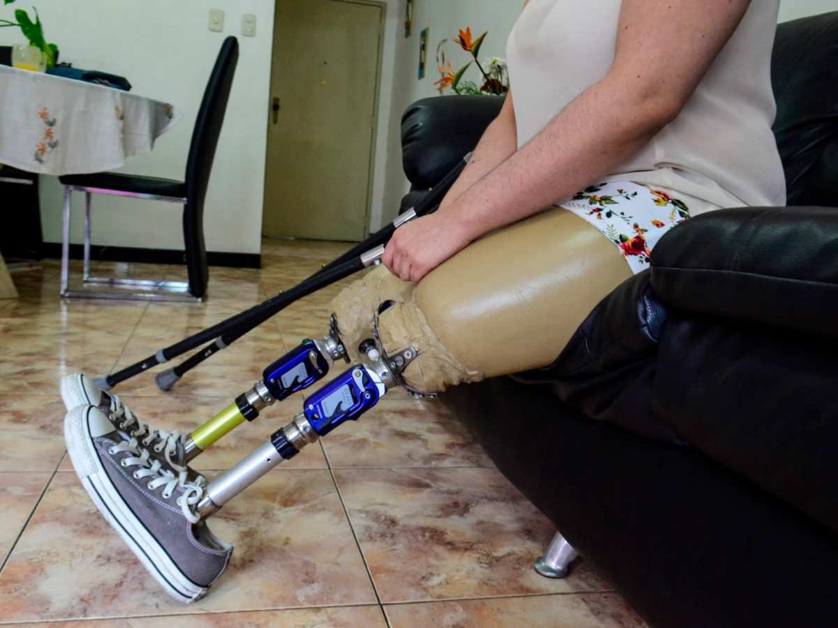 Cientos de sobrevivientes del doble sismo enfrentan amputaciones sin acceso a prótesis y rehabilitación