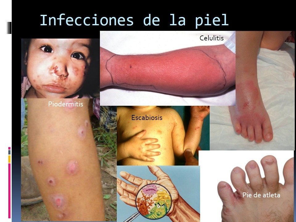 Aguas contaminadas generan enfermedades parasitarias