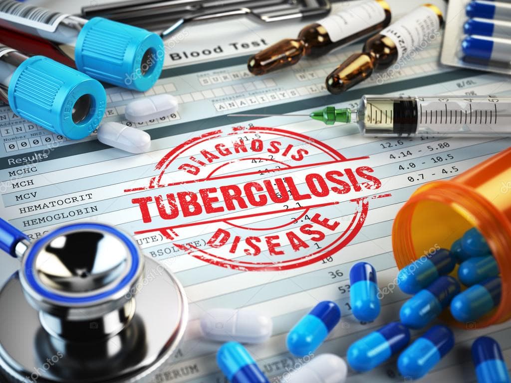 Tuberculosis en Bolívar se alimenta de la minería y el hacinamiento carcelario