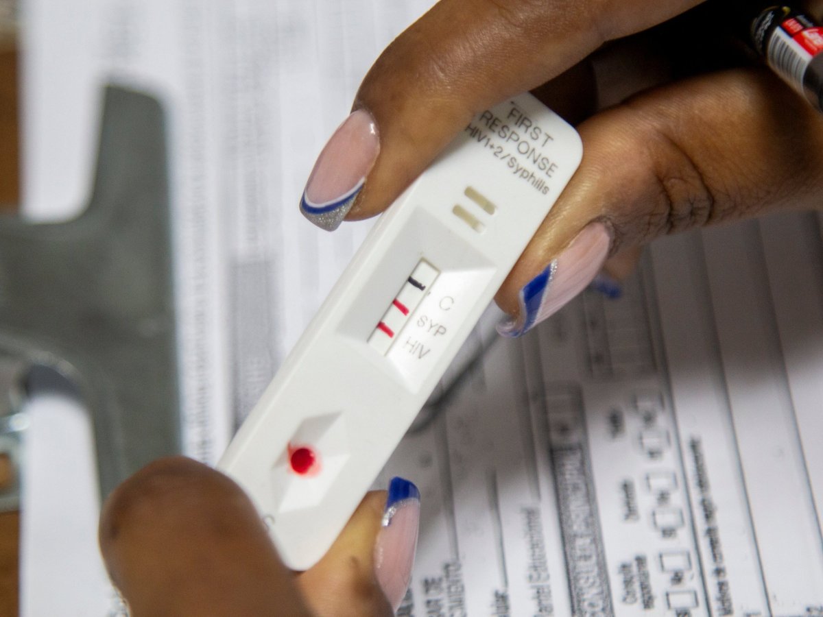 En claves: lo que debe saber sobre el virus Oropouche