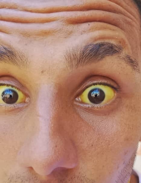 Excarcelado poselectoral